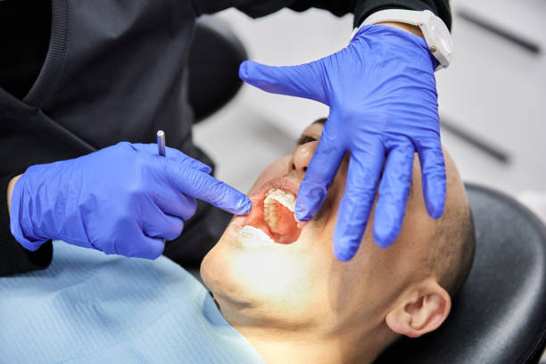 Best Emergency Gum Treatment in Port Republic, NJ